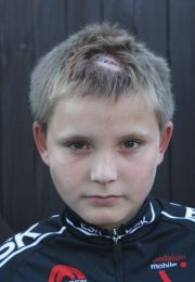 Philipp_kopfwunde_1243