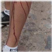 hu_knie